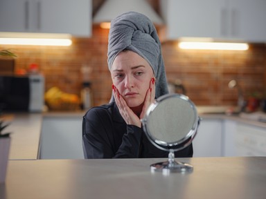 Ezt teszi a stressz a bőröddel - 5 tipp, hogy elfelejtsd a stressz okozta bőrproblémákat