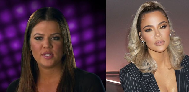 A legnagyobb átváltozáson kétség kívül Khloé Kardashian esett át. Khloét az utóbbi időben rengeteget támadták a túlphotoshoppolt, viaszbabára emlékeztető fotói miatt. De nem csak a Photoshop, a Kardashian család sebészének keze is benne van a nagy átalakulásban.