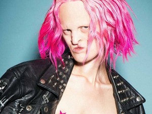 Különös genetikai rendellenességgel küzd a modell, de még ez sem állíthatja meg