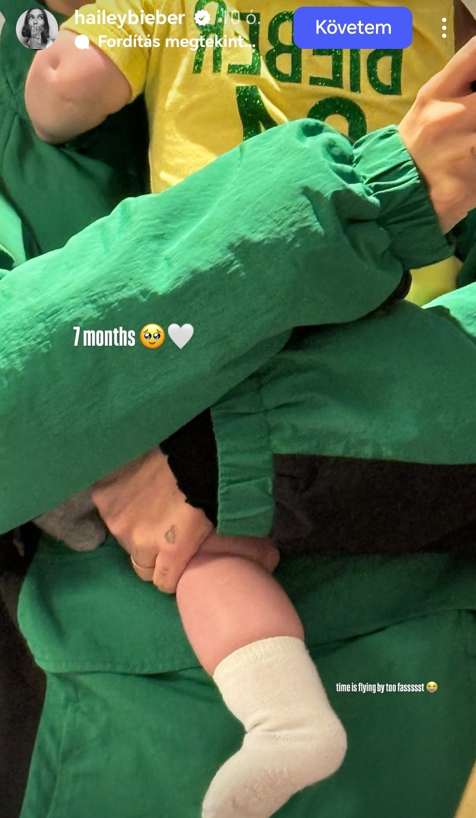 Hailey Bieber és Justin Bieber kisfia elképesztően nagyot nőtt