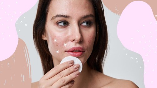 Pattanás vagy furunkulus? Nagyon nem mindegy! Te tudod, mi a különbség?